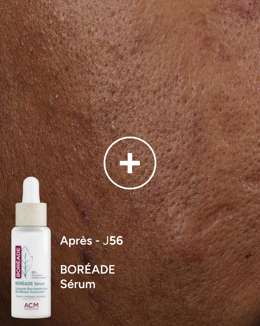 Boréade Sérum - Image 4